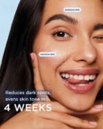 Shiv Aatman Dark Spots Removal Cream - Image 3