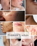 Shiv Aatman Dark Spots Removal Cream - Image 5