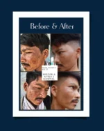 Shiv Aatman Anti Pigmentation Cream for Cure of Melasma, Hyperpigmentation, Dark  Spots, Sunburn, Tanned, Damaged Skin - Image 5