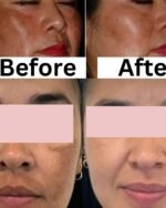 Shiv  Aatman 11 Heal  Gel Face Gel for  Spotless Clean Skin - Image 3