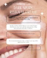 Shiv Aatman Dark Spots Removal Cream - Image 14