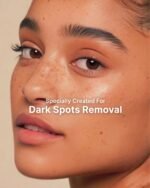 Shiv Aatman Dark Spots Removal Cream - Image 8