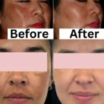 Shiv Aatman Anti Pigmentation Cream for Cure of Melasma, Hyperpigmentation, Dark  Spots, Sunburn, Tanned, Damaged Skin - Image 9