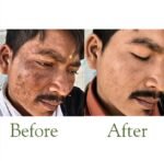 Pack of 2 (60 Days Course) - Shiv Aatman Anti Pigmentation Cream for Cure of Melasma, Hyperpigmentation, Dark  Spots, Sunburn, Tanned, Damaged Skin. 100% Results - Image 6