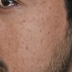 Pack of 2 (60 Days Course) - Shiv Aatman Anti Pigmentation Cream for Cure of Melasma, Hyperpigmentation, Dark  Spots, Sunburn, Tanned, Damaged Skin. 100% Results photo review